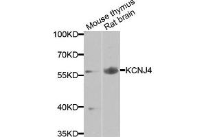 Western blot analysis of extracts of various cells, using KCNJ4 antibody. (KCNJ4 Antikörper)