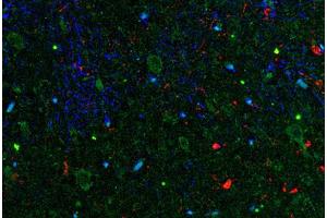 Image no. 1 for anti-Interleukin 11 (IL11) antibody (ABIN465009) (IL-11 Antikörper)