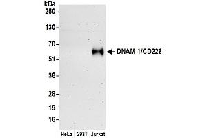 Western Blotting (WB) image for anti-CD226 (CD226) (AA 286-336) antibody (ABIN7450178)