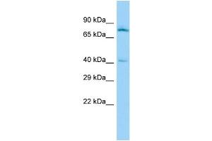Host: Rabbit Target Name: SKAP2 Sample Type: PANC1 Whole Cell lysates Antibody Dilution: 1. (SKAP2 Antikörper  (Middle Region))