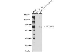 Immunoprecipitation analysis of 200 μg extracts of Jurkat cells, using 3 μg Phospho--S473 pAb (ABIN1513328, ABIN5664973, ABIN5664975 and ABIN6225474). (AKT1 Antikörper  (pSer473))