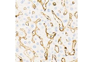 Immunohistochemistry of paraffin-embedded human liver using Annexin  Rabbit pAb  at dilution of 1:25 (40x lens). (Annexin A2 Antikörper)