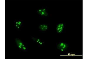 Immunofluorescence of purified MaxPab antibody to UTP14A on HeLa cell. (UTP14A Antikörper  (AA 1-771))