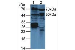 Western blot analysis of (1) Mouse Brain Tissue and (2) Mouse Breast Tissue. (VEGFC Antikörper  (AA 108-223))