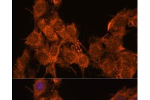 Immunofluorescence analysis of C6 cells using SNX15 Polyclonal Antibody at dilution of 1:100. (SNX15 Antikörper)