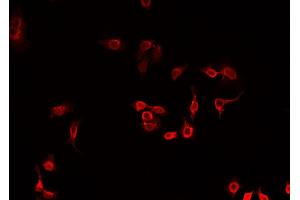 ABIN6269210 staining A549 cells by IF/ICC. (MARCKS Antikörper  (Internal Region))