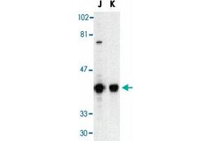 Western blot analysis of DFFB in Jurkat (J) and K-562 (K) whole cell lysate with DFFB polyclonal antibody  at 1 : 500 dilution. (DFFB Antikörper  (AA 3-18))