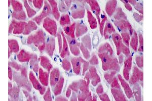 Anti-SERCA1 antibody IHC of human heart.