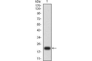 Western blot analysis using WT1 mAb against human WT1 (AA: 1-181) recombinant protein. (WT1 Antikörper  (AA 1-181))