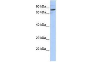 Image no. 1 for anti-serine Palmitoyltransferase, Long Chain Base Subunit 2 (SPTLC2) (AA 72-121) antibody (ABIN6741036) (SPTLC2 Antikörper  (AA 72-121))