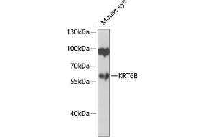 Western blot analysis of extracts of mouse eye, using KRT6B antibody (ABIN6129538, ABIN6143035, ABIN6143036 and ABIN6223626) at 1:1000 dilution. (Keratin 6B Antikörper  (AA 1-280))