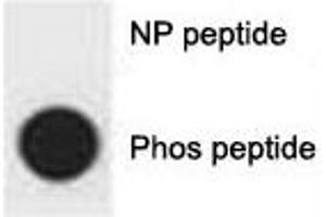 Dot blot analysis of p-p62 antibody. (SQSTM1 Antikörper  (pSer403))