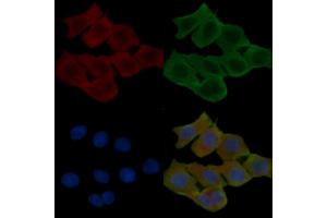 ABIN6257255 and ABIN6274428 staining Hela cells(24h of starvation treatment) by IF/ICC.