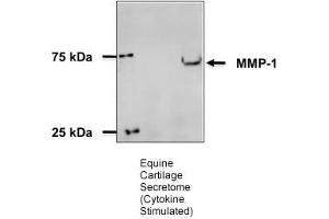 Western Blotting (WB) image for anti-Matrix Metallopeptidase 1 (Interstitial Collagenase) (MMP1) (N-Term) antibody (ABIN2777119)