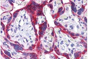 Human Placenta: Formalin-Fixed, Paraffin-Embedded (FFPE) (ATG9B Antikörper  (C-Term))