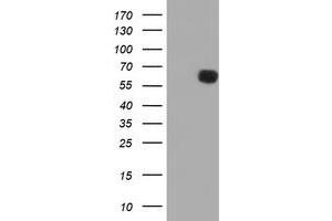 Western Blotting (WB) image for anti-Phosphoribosyl Pyrophosphate Amidotransferase (PPAT) (AA 42-278) antibody (ABIN1491503) (PPAT Antikörper  (AA 42-278))