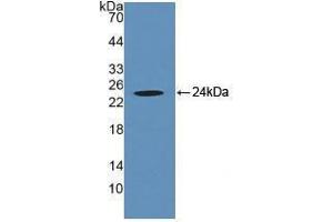 Western blot analysis of recombinant Human CRYaB. (CRYAB Antikörper  (AA 1-175))