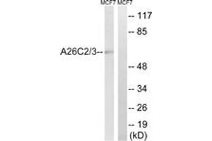 Western blot analysis of extracts from MCF-7 cells, using A26C2/3 Antibody. (A26C2/3 (AA 178-227) Antikörper)
