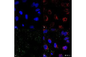 Immunocytochemistry/Immunofluorescence analysis on permeabilized HCT116 cells using Mouse Anti-HSP70 Monoclonal Antibody, Clone 1H11: FITC conjugate  showing faint cell membrane and intracellular staining. (HSP70 Antikörper)