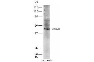 Mouse testis lysates probed with Rabbit Anti-ERCC*/CSA Polyclonal Antibody, Unconjugated (ABIN1713778) at 1:300 overnight at 4 °C. (ERCC8 Antikörper  (AA 161-260))