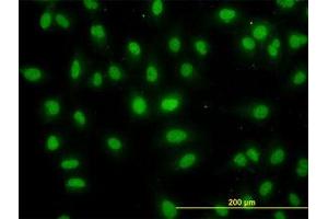Image no. 5 for anti-DEAD (Asp-Glu-Ala-Asp) Box Polypeptide 56 (DDX56) (AA 450-548) antibody (ABIN599259) (DDX56 Antikörper  (AA 450-548))