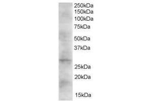 Image no. 1 for anti-Dickkopf 2 Homolog (DKK2) (C-Term) antibody (ABIN374181) (DKK2 Antikörper  (C-Term))
