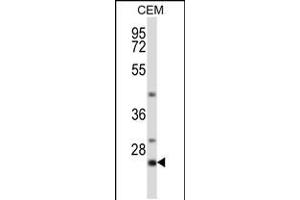 Western blot analysis in CEM cell line lysates (35ug/lane). (LIME Antikörper  (C-Term))