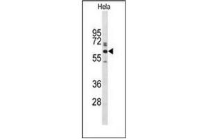 Western blot analysis of Glypican-1 / GPC1Antibody (N-term) in Hela cell line lysates (35ug/lane). (GPC1 Antikörper  (N-Term))