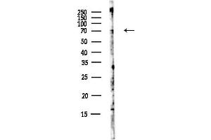 anti-AT Rich Interactive Domain 5A (MRF1-Like) (ARID5A) antibody