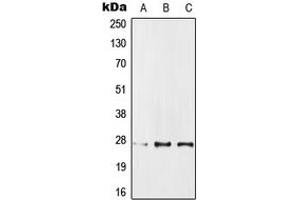 Western blot analysis of IPP1 expression in MCF7 (A), SP2/0 (B), PC12 (C) whole cell lysates. (PPP1R1A Antikörper  (Center))