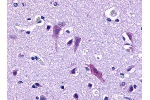 Immunohistochemical staining of Brain (Neurons and Glia) using anti- GPR103 antibody ABIN122109 (QRFPR Antikörper)