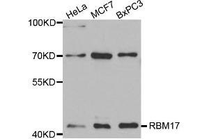Western Blotting (WB) image for anti-RNA Binding Motif Protein 17 (RBM17) antibody (ABIN1875451) (RBM17 Antikörper)