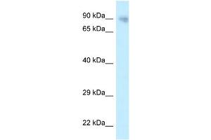 WB Suggested Anti-PPP6R3 Antibody Titration: 1. (PPP6R3 Antikörper  (N-Term))