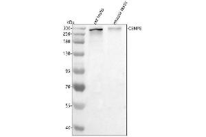 Western blot analysis of Cenpe using anti-Cenpe antibody (ABIN7600005).