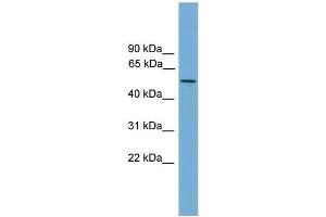 Human NCI-H226; WB Suggested Anti-EFCAB3 Antibody Titration: 0. (EFCAB3 Antikörper  (N-Term))