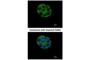 ICC/IF Image Immunofluorescence analysis of methanol-fixed Hep G2, using ASB5, antibody at 1:500 dilution. (ASB5 Antikörper)