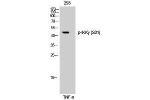 Western Blotting (WB) image for anti-Inhibitor of kappa Light Polypeptide Gene Enhancer in B-Cells, Kinase gamma (IKBKG) (pSer31) antibody (ABIN3182524) (IKBKG Antikörper  (pSer31))