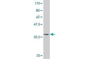 Western Blot detection against Immunogen (36. (CITED1 Antikörper  (AA 94-193))