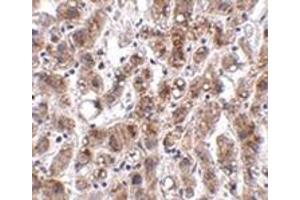 Immunohistochemistry of THEM2 in human liver tissue with this product at 2.