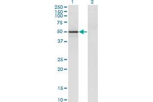 Western Blot analysis of VIL1 expression in transfected 293T cell line by VIL1 monoclonal antibody (M26), clone 2F10.