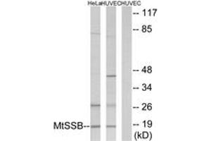 Western blot analysis of extracts from HuvEc/HeLa cells, using MtSSB Antibody.