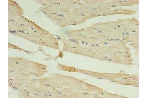 Immunohistochemistry of paraffin-embedded human skeletal muscle tissue using ABIN7146727 at dilution of 1:100 (CA5B Antikörper  (AA 34-314))