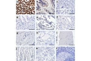 Immunohistochemical staining of various human tissues with hematoxylin and CPS1 antibody under high magnification.