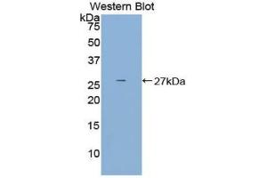 Western blot analysis of the recombinant protein. (DCL1 Antikörper  (AA 21-225))