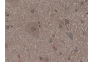 Detection of MFAP2 in Rat Spinal cord Tissue using Polyclonal Antibody to Microfibrillar Associated Protein 2 (MFAP2) (MFAP2 Antikörper  (AA 8-171))