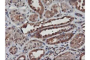 Immunohistochemical staining of paraffin-embedded Human Kidney tissue using anti-AKT1 mouse monoclonal antibody. (AKT1 Antikörper)