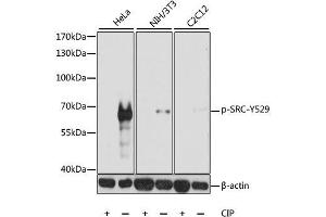 Western blot analysis of extracts of various cell lines, using Phospho-SRC-Y529 antibody. (Src Antikörper  (pTyr529))
