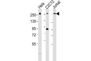 All lanes : Anti-Med12 Antibody (C-term) at 1:2000 dilution Lane 1: Hela whole cell lysates Lane 2: C2C12 whole cell lysates Lane 3: Jurkat whole cell lysates Lysates/proteins at 20 μg per lane. (MED12 Antikörper  (C-Term))