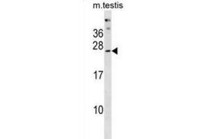 Western Blotting (WB) image for anti-Phosphatase, Orphan 2 (PHOSPHO2) antibody (ABIN3001017) (PHOSPHO2 Antikörper)