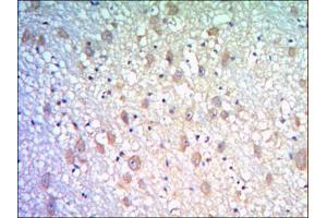 Immunohistochemical analysis of paraffin-embedded human brain tissues using KLHL21 antibody with DAB staining. (KLHL21 Antikörper)